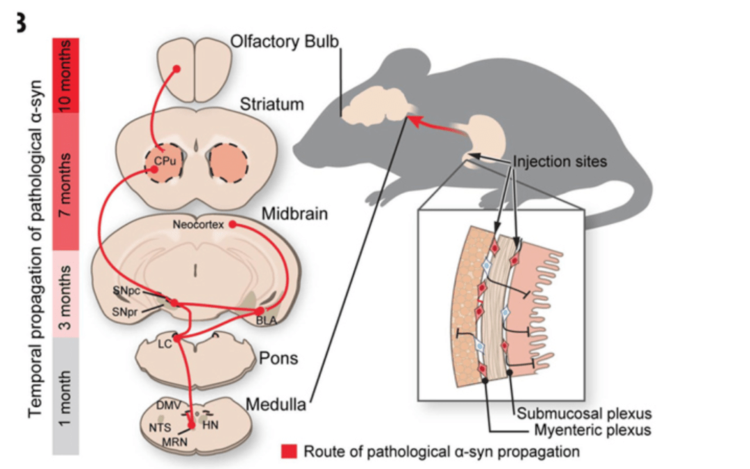 New Animal Study Adds to Evidence of Parkinson’s Disease Origins in the Gut