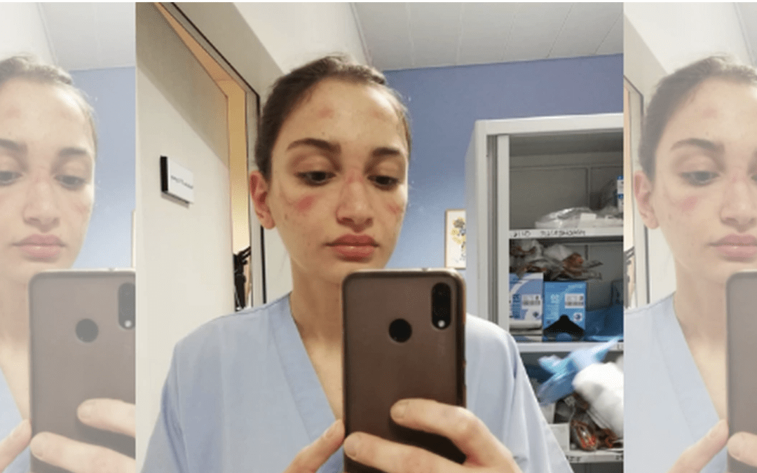 Coronavirus: Nurse’s Photo Goes Viral and Her Words Will Give You Goosebumps