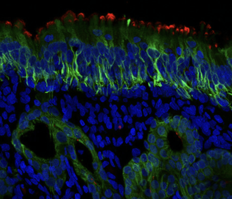 Image of the Month: Losing your smell